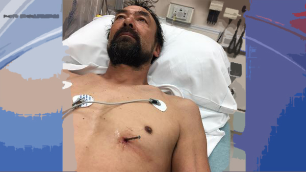 'It didn't really hurt': Peshtigo man's heart pierced in nail gun accident