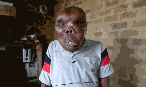 Uganda's 'most unusual looking person' launches unlikely career as pop star