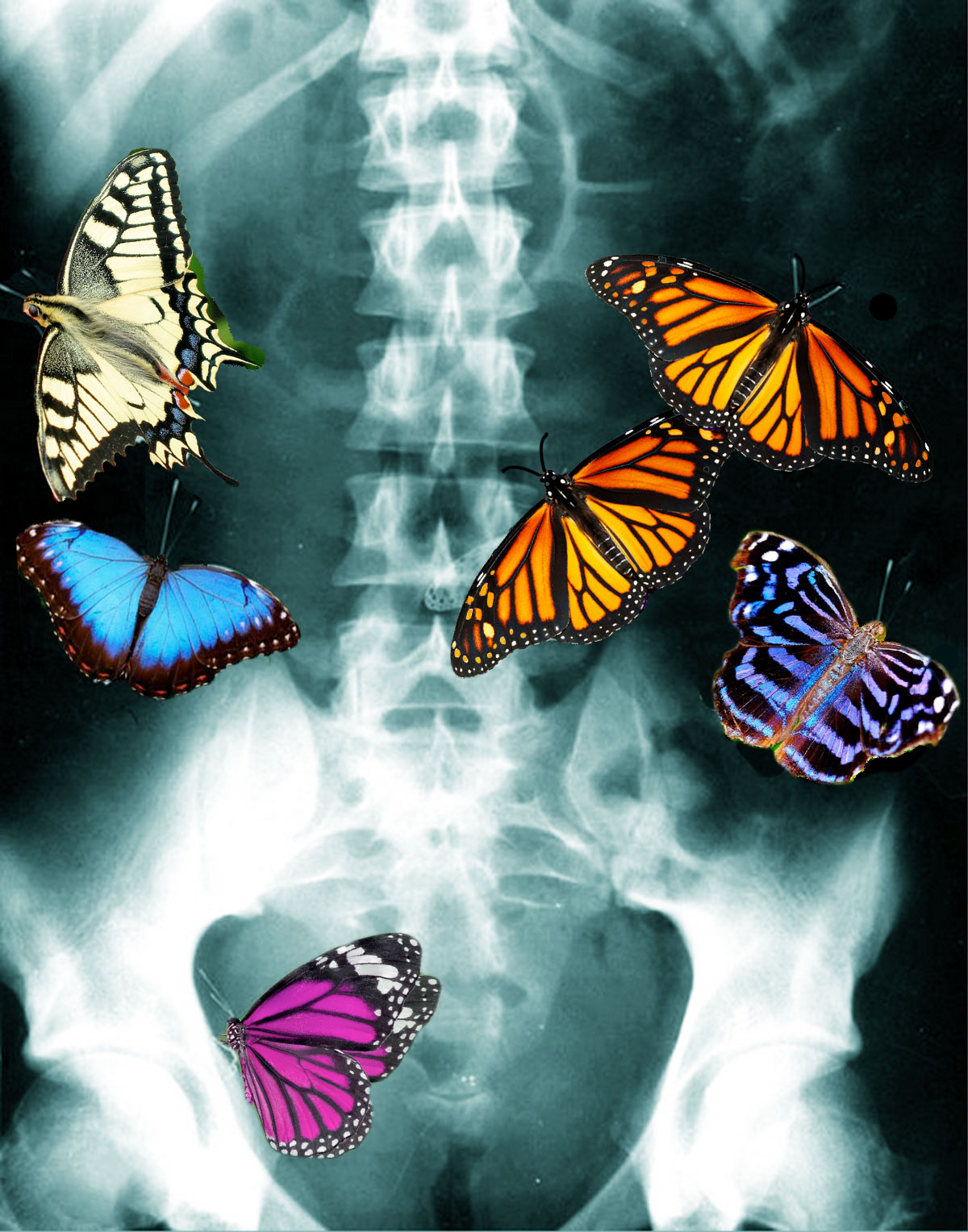 What Causes “Butterflies in the Stomach”?