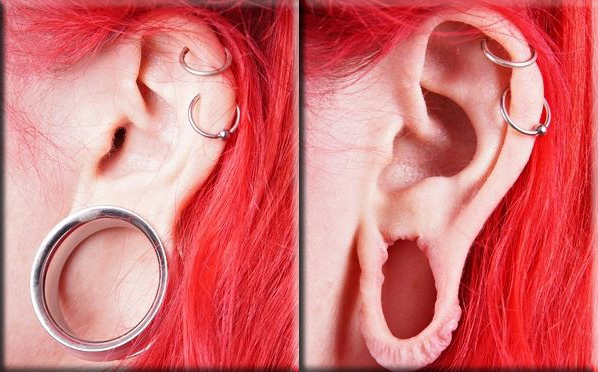 Big increase in surgery to mend “flesh tunnel” earlobes (The Guardian)